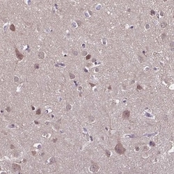 DIP2B Antibody, Novus Biologicals 25 &mu;L, Unlabeled:Antibodies, Polyclonal